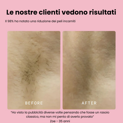 Velora™ - Rasoio 2 in 1